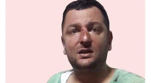 Deliyle şaka kanlı bitti