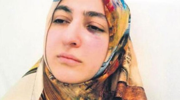 ‘Dişimi acıttın’ deyip diş hekimini dövdü