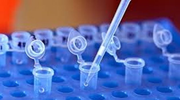 DNA testi nedir, nerelerde kullanılır