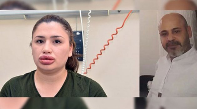 Dudakçı cezaevinden kaçtı