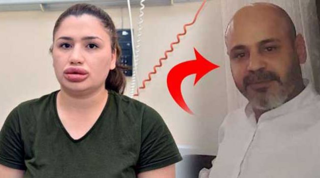 Dudakçı tahliye oldu