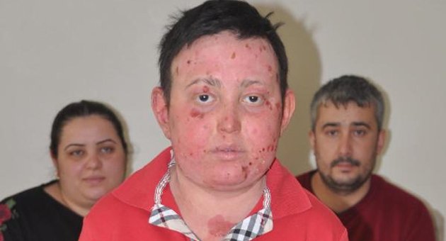 Emirhan, kesin tedavisi olmayan hastalıkla mücadele ediyor