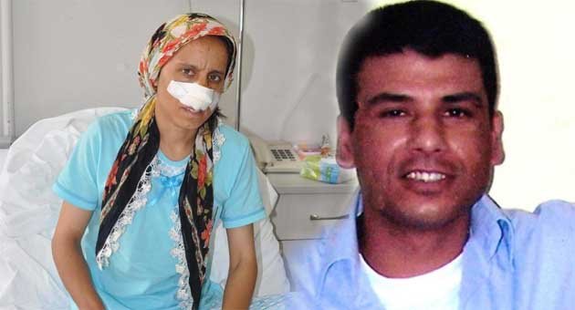Eşinin burnunu kesen koca hakkında işkence suçundan da ceza istendi