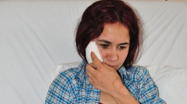 Eski eşini yaralayan kocaya 5 yıl hapis verildi