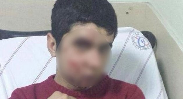 Gaz kapsülü değil taş yaraladı