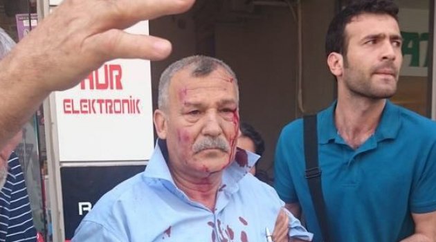 İki bombalı saldırıdan sağ kurtuldu