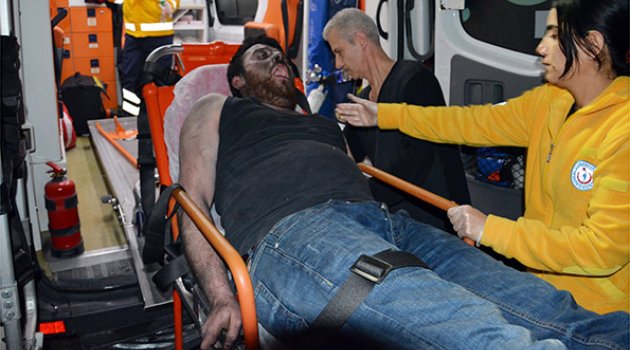 Kendi yaktığı evinde ağır yaralandı