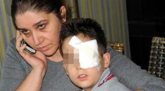 Kitapla vurup öğrencisini yaralayan öğretmene dava