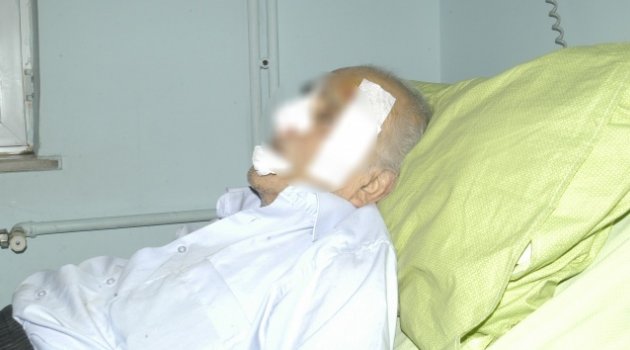 Kocasını bastonla vurarak bu hale getirdi