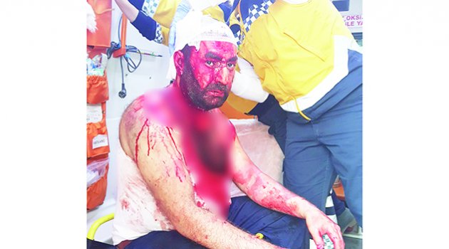 Kocasını bu hale getiren kadın tutuklandı