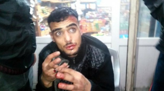 Mahalleliden hırsıza meydan dayağı