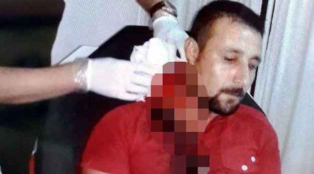 Mesai arkadaşını falçatayla yaraladı