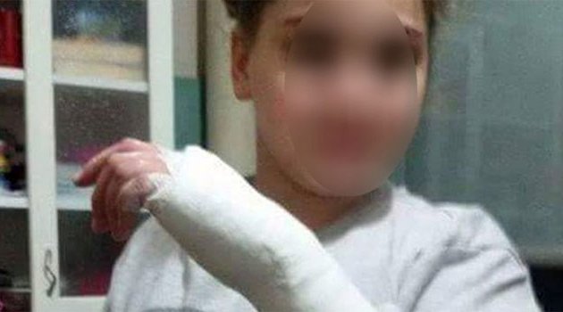 Ödevini yapmayan öğrencisinin elini cetvelle kırdı