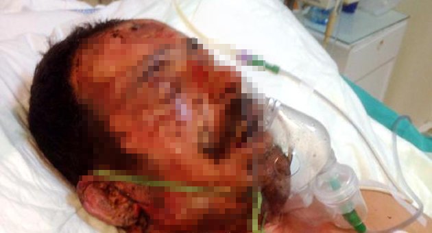 Oğlu sopayla vurdu, eşi benzin döküp yaktı