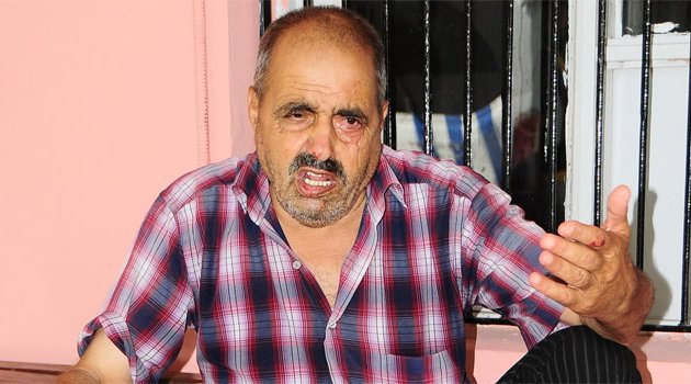 Oğlundan dayak yiyen babanın isyanı