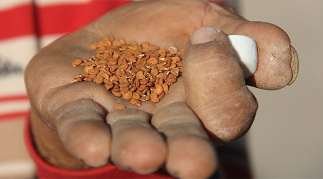 Hemoroid oldu, bitkisel çaresini buldu