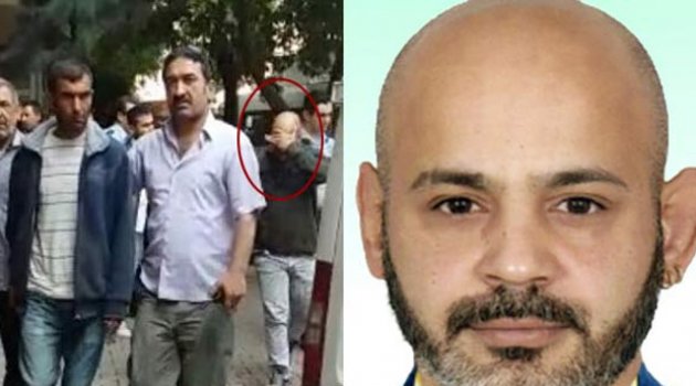 Sahte Estetik Uzmanı Kuaför, Cezaevine Gönderildi