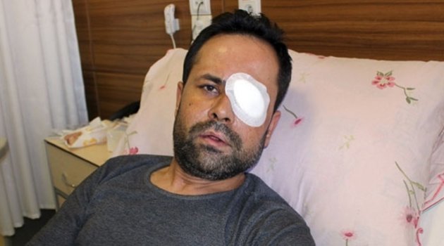 Servisi beğenmedi garsonu kör etti