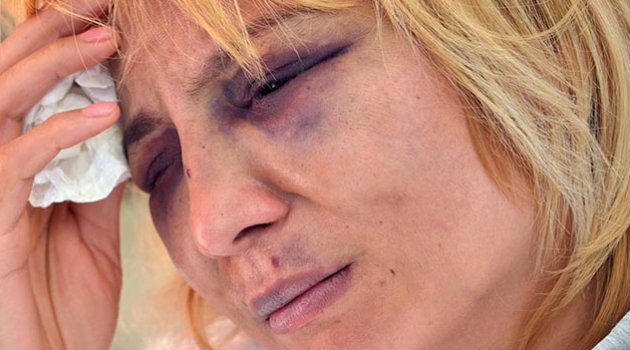 Şiddet mağduru Özbek kadına Başsavcılık sahip çıktı