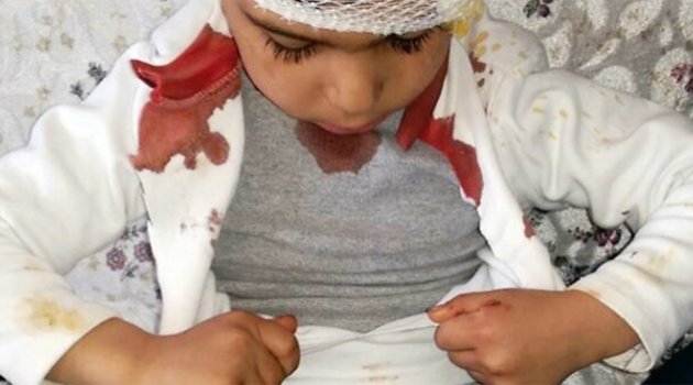 Sokak köpeği dehşet saçtı! 3 günde 15 kişi