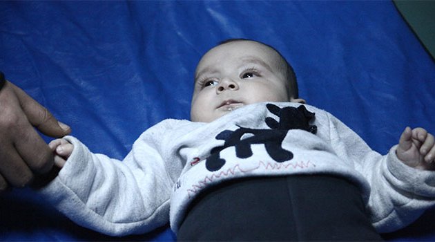 Suriyeli çocuklar Adana’da tedavi altına alındı