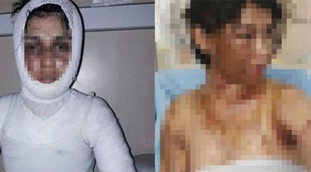 Uykuda asitli saldırıya uğradılar