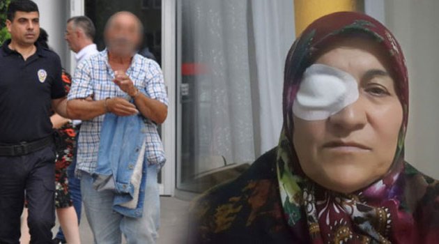 Uzaklaştırma cezası alınca eşinin yüzüne tuz ruhu döktü