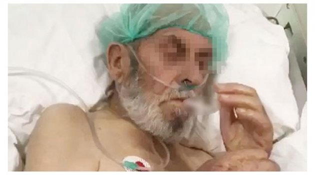 Yoğun bakım hastasına sigara verdiler