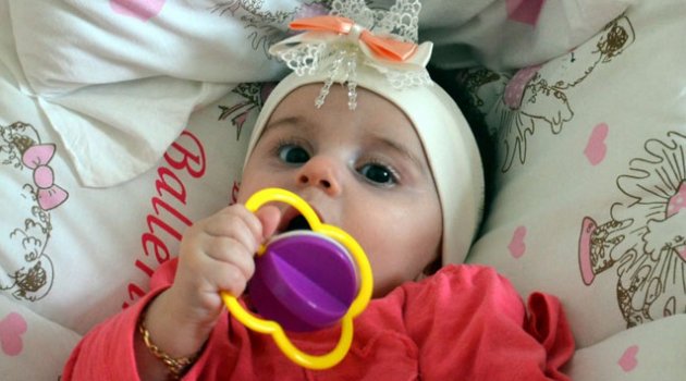 Zeynep bebek, yaşamını tek kolu ile sürdürecek