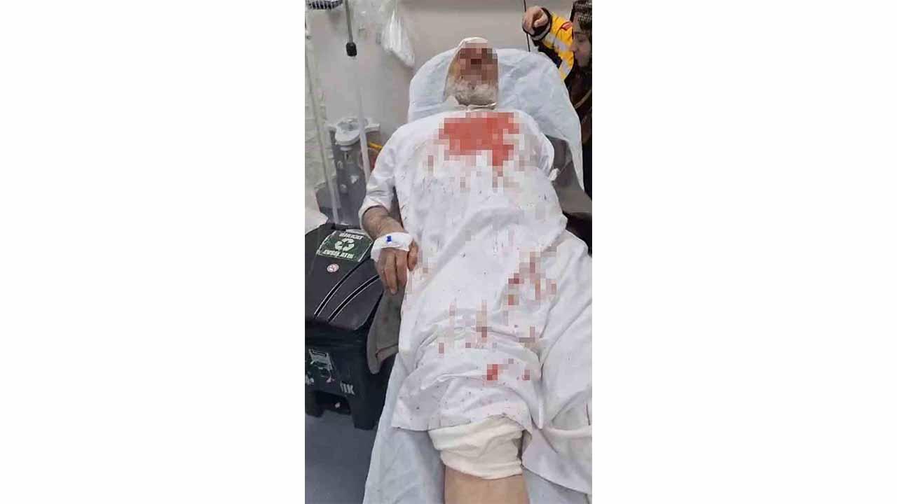 72 Yaşındaki Adamı Öldüresiye Dövdüler