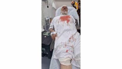 72 Yaşındaki Adamı Öldüresiye Dövdüler