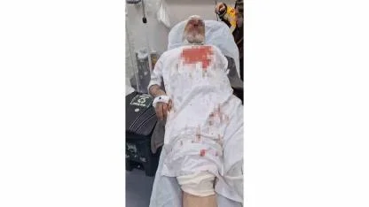 72 Yaşındaki Adamı Öldüresiye Dövdüler