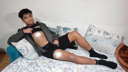 Akran Zorbalığı! 15 Yaşındaki Genç Bıçaklandı