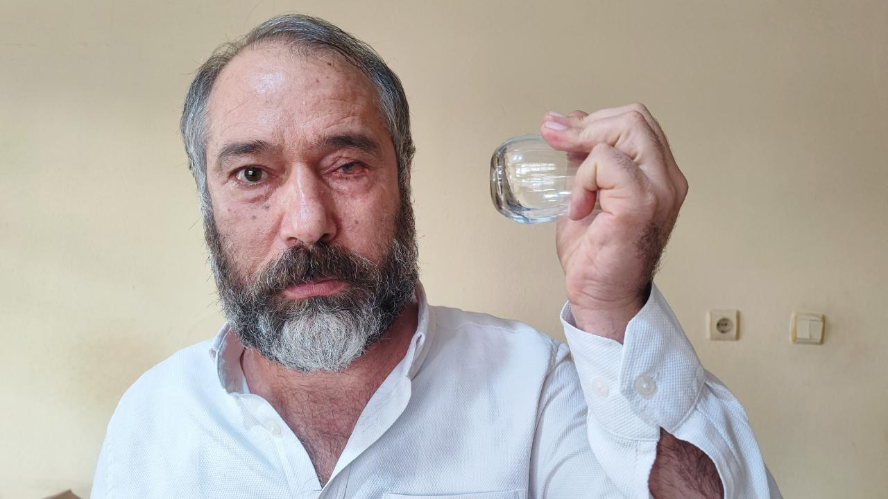 Küfür Uyarısı Gözünden Etti