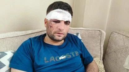 Yaralı Sürücüden ''Bırakıp Kaçtılar'' İddiası