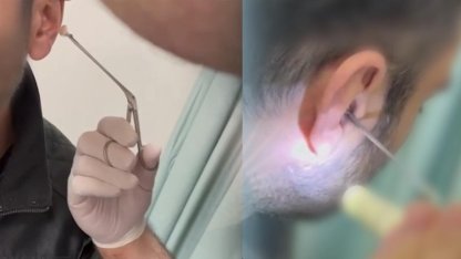 Uyuşturucuyu Sakladığı Yer Ekipleri Bile Şaşkına Çevirdi!