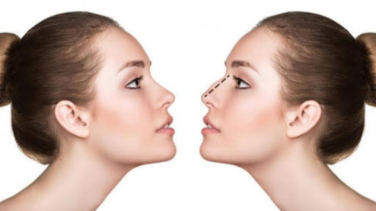 Burun Estetiği Nefes Almak İçin Önemli