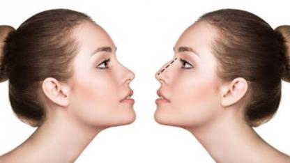 Burun Estetiği Nefes Almak İçin Önemli