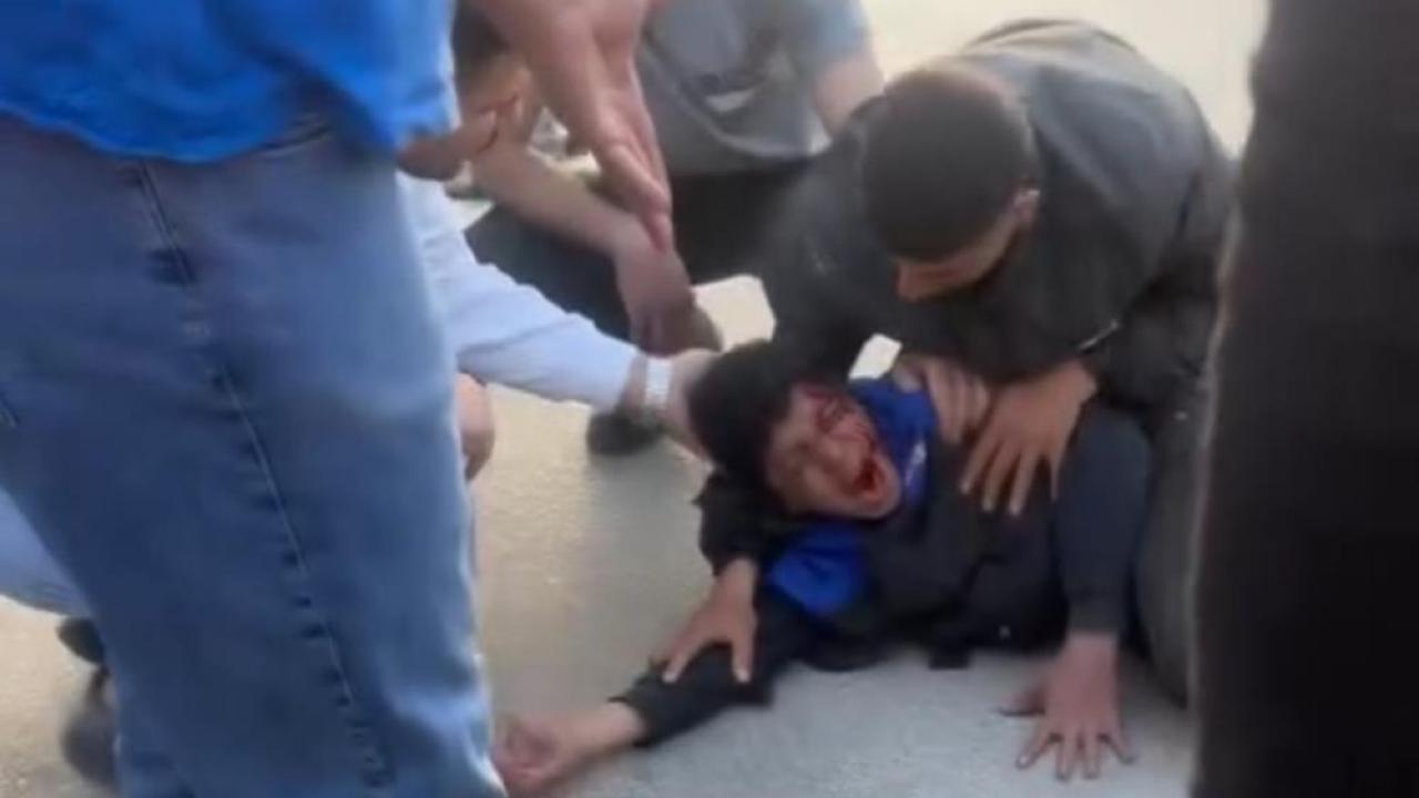 Korkunç Kaza:Sürücü Havada Savruldu