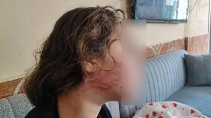 Epilepsi Hastası Çocuğa Şiddet İddiası:Yüzü Şişti, Dişleri Kırıldı